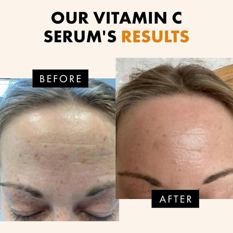 Suero Iluminador Con Vitamina C 30ml