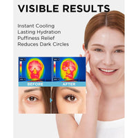 The SAEM Iceland Hydrating Eye Stick - Bálsamo Refrescante para Ojeras e Hinchazón con Ingredientes Marinos