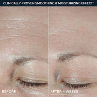 RoC Hidratante Facial Hydration+ 50ml Con Ácido Hialurónico