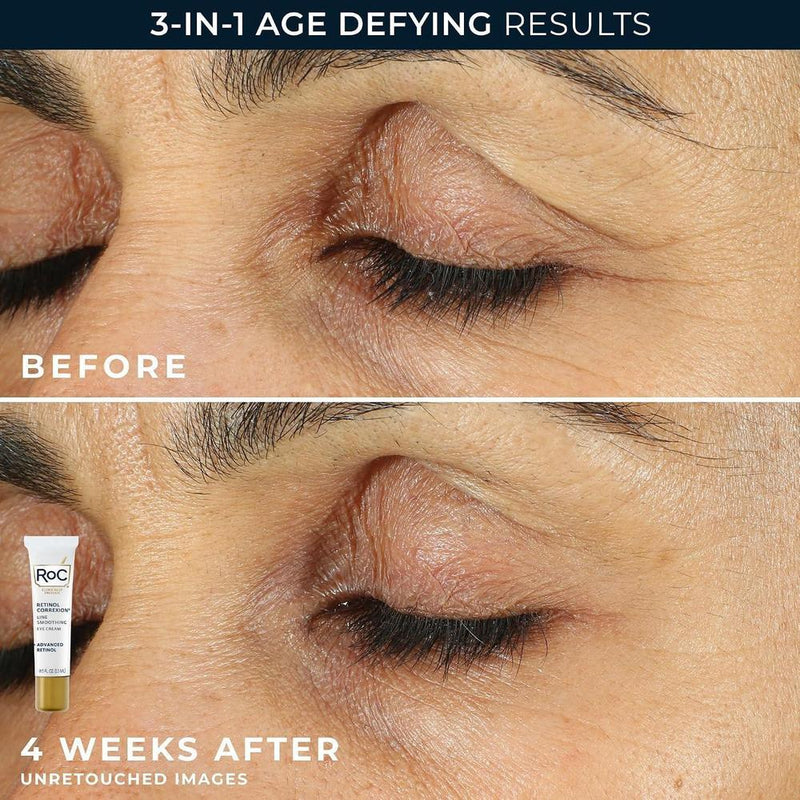 Conjunto Roc: Crema De Noche Y Ojos Con Retinol + 45ml