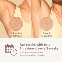 Philips Lumea 9000 Series - Dispositivo de depilación IPL para hombres y mujeres con tecnología SenseIQ, 4 accesorios