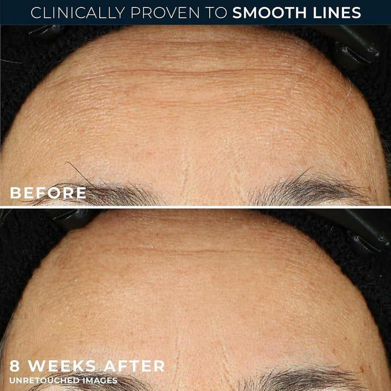 Roc Retinol Correxion Suero Noche Antienvejecimiento Para Arrugas Y Líneas Finas 30ml