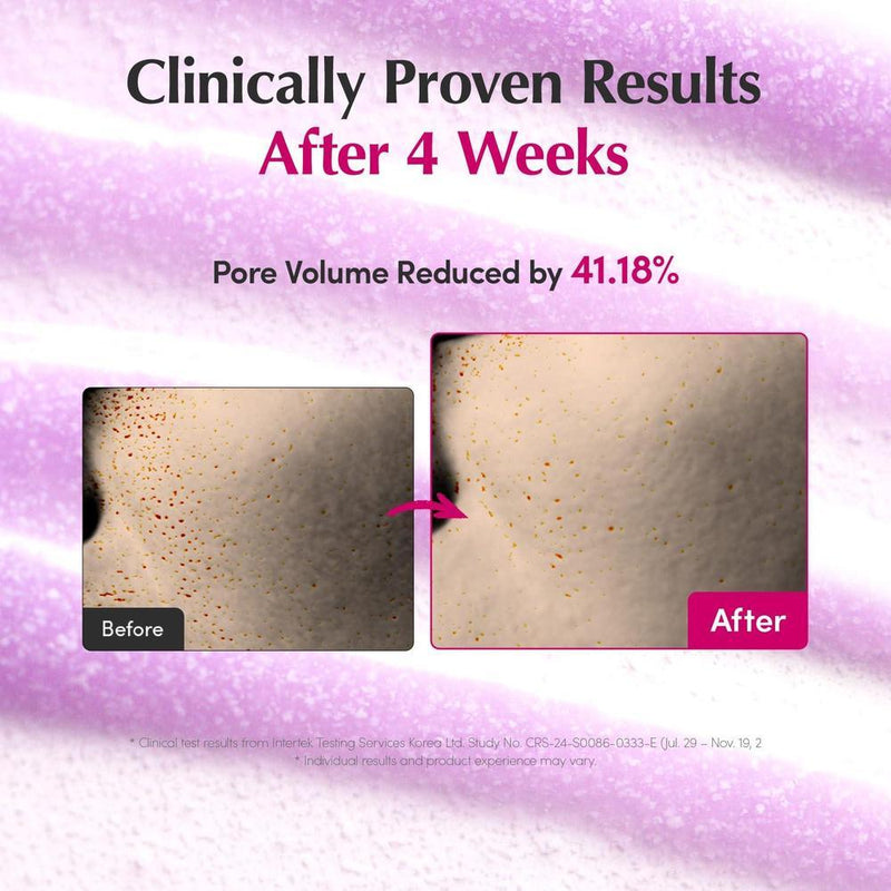 Eqqualberry Suero Facial Plumping Bakuchiol 5000ppm 4% Niacinamida Ácido Hialurónico Piel Sensible 30ml