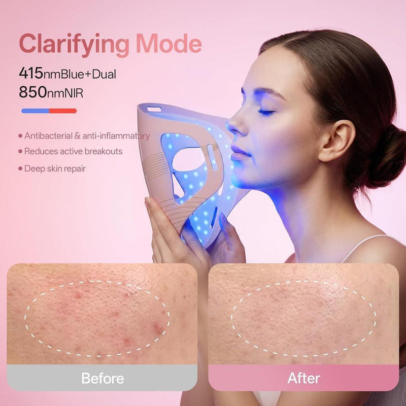 Terapia de luz roja profesional para cara y mandíbula, mascarilla LED 4D inalámbrica con 324 LEDs