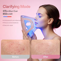 Terapia de luz roja profesional para cara y mandíbula, mascarilla LED 4D inalámbrica con 324 LEDs