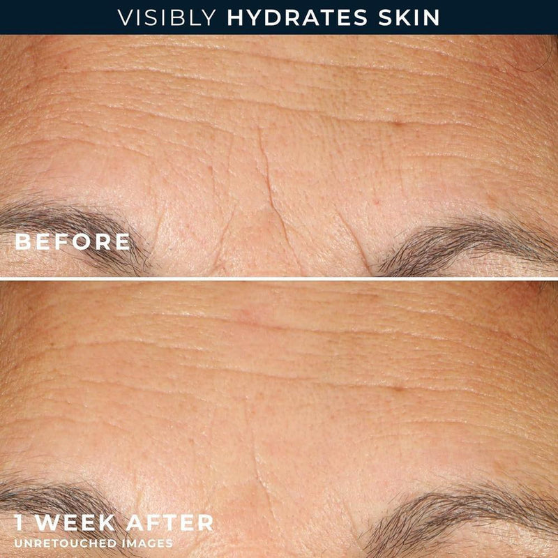 Roc Suero Ácido Hialurónico + Retinol 30ct Intense Hydration 5L