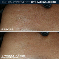 RoC Hidratante Facial Antienvejecimiento con Retinol y Ácido Hialurónico para Líneas Finas, Manchas Oscuras y Cicatrices