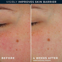 Roc Barrier Renew Con Spf 30, Crema Hidratante Y Protectora Con Ceramidas Y Prebióticos Para Todo Tipo De Piel, 70.87 G