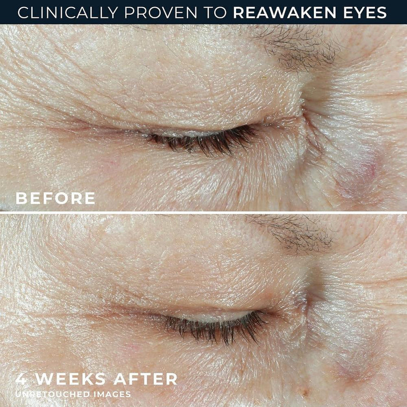 Roc Crema Para Ojos Ácido Hialurónico 1.5% 15ml