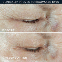 Roc Crema Para Ojos Ácido Hialurónico 1.5% 15ml