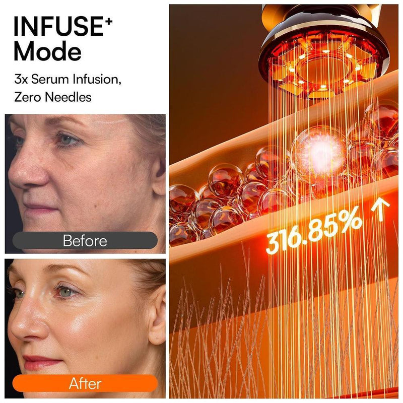 INIA Flare - Dispositivo facial de microcorriente 3 en 1 con terapia de luz roja y masajeador para cara y cuello
