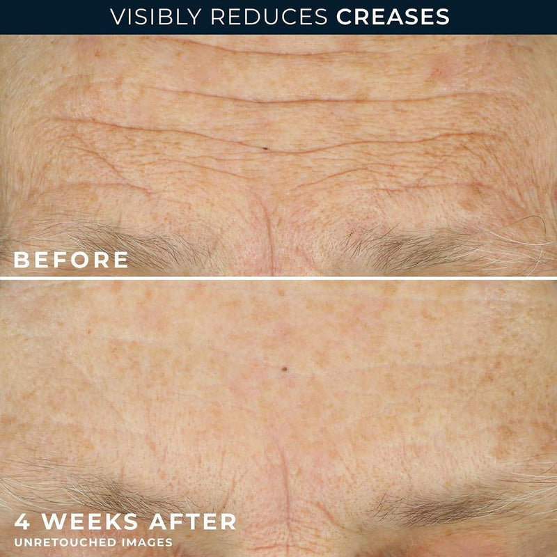 RoC Crema diaria antienvejecimiento para arrugas en rostro y cuello con cápsulas de retinol para suavizar líneas de expresión