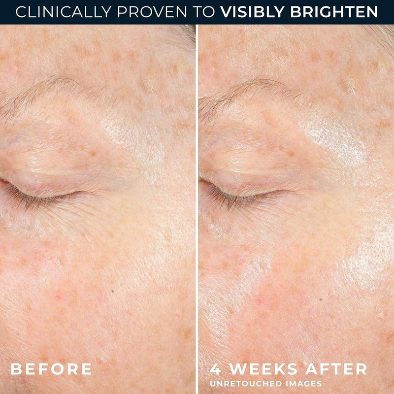 RoC Revive + Glow Hidratante Facial 10% Vitamina C Gel Antienvejecimiento Hipoalergénico Sin Aceite 50ml