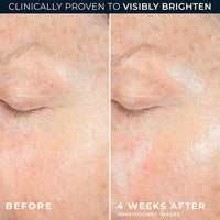 RoC Revive + Glow Hidratante Facial 10% Vitamina C Gel Antienvejecimiento Hipoalergénico Sin Aceite 50ml