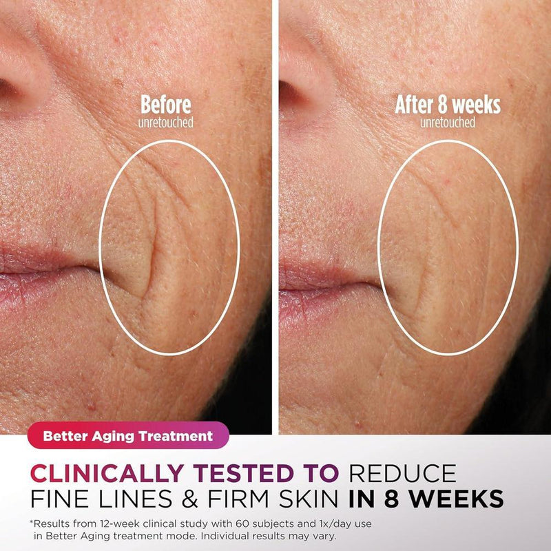 Mascarilla facial LED Shark CryoGlow con enfriamiento ocular, antienvejecimiento y reparación de imperfecciones, USB-C y control remoto