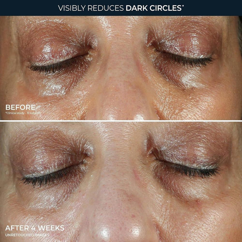 RoC Multi Correxion Crema de ojos antienvejecimiento para hinchazón y ojeras con manteca de karité