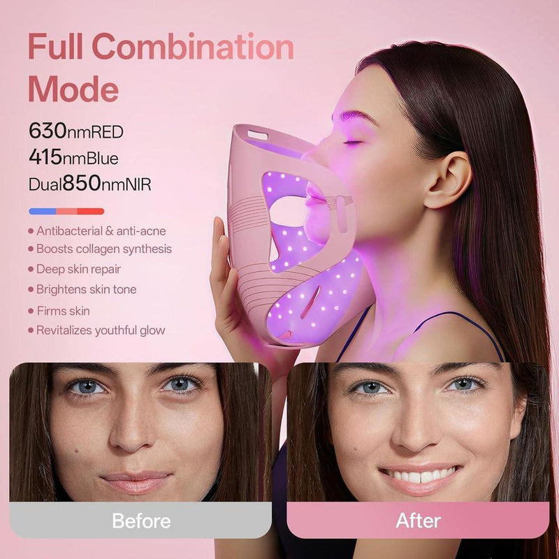 Terapia de luz roja profesional para cara y mandíbula, mascarilla LED 4D inalámbrica con 324 LEDs