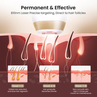 Depilación láser DermRays para hombres y mujeres, reducción permanente del vello, dispositivo aprobado por la FDA