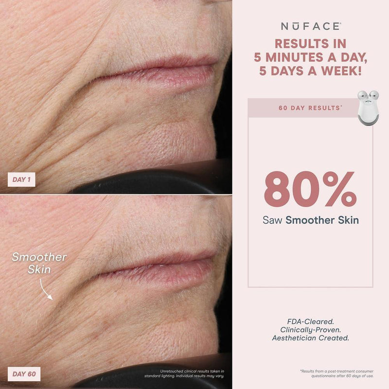 NuFACE MINI Classic Microcurrent, dispositivo facial para contornear, levantar, suavizar y tonificar con gel activador