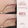 NuFACE MINI Classic Microcurrent, dispositivo facial para contornear, levantar, suavizar y tonificar con gel activador