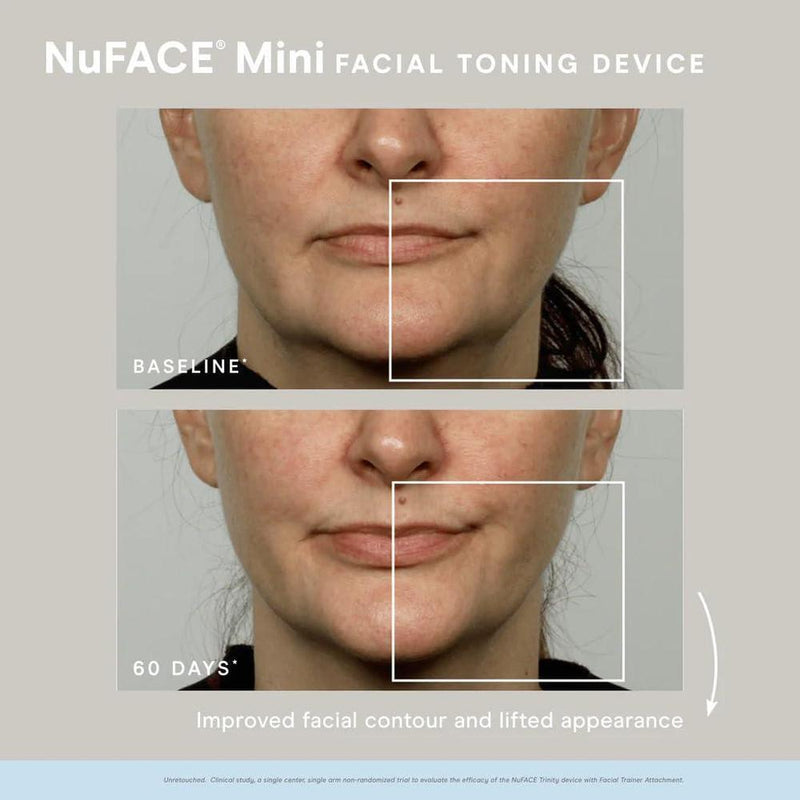 Dispositivo portátil NuFACE Mini para tonificación de la piel del rostro, mejora el contorno y reduce líneas finas
