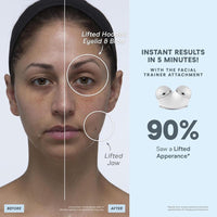 Dispositivo facial NuFACE Trinity+ de microcorriente, esculpe y aprieta rostro y cuello, aprobado por la FDA, incluye activador