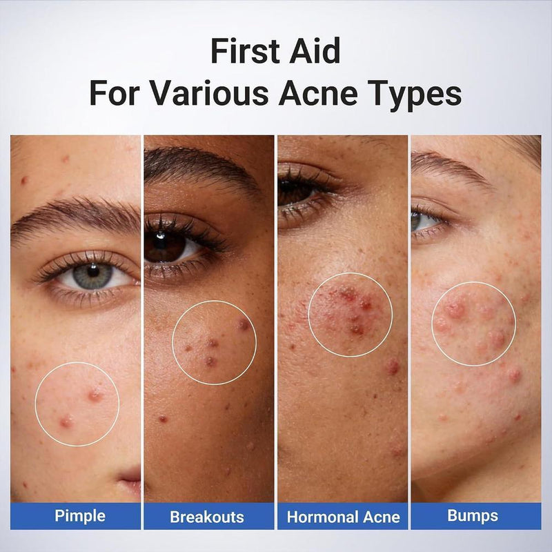 Tratamiento De Manchas De Acné Con Ácido Salicílico Dr.Leo 1.8%, 20ml