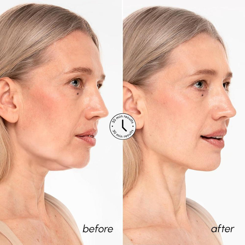Máscara de elevación MAREE V Line con oro de 24k, colágeno profundo para mujeres, reafirma cuello y mandíbula con retinol y ácido hialurónico