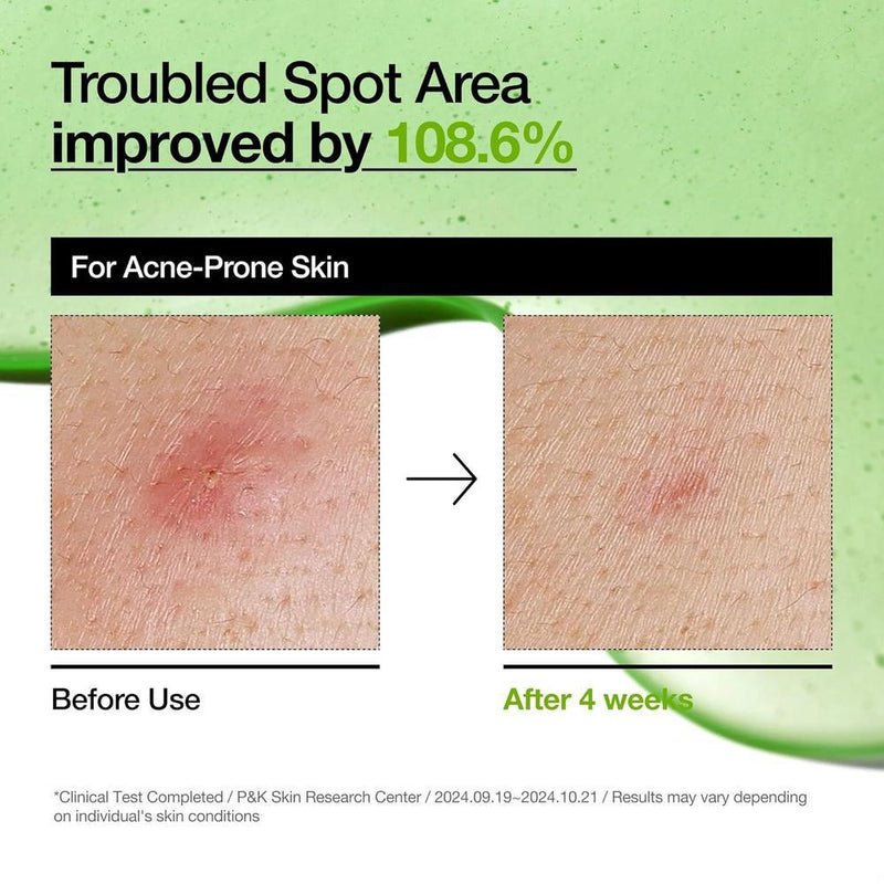 Suero Anua Ácido Azelaico 10% Hialurónico 30ml