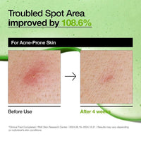 Suero Anua Ácido Azelaico 10% Hialurónico 30ml