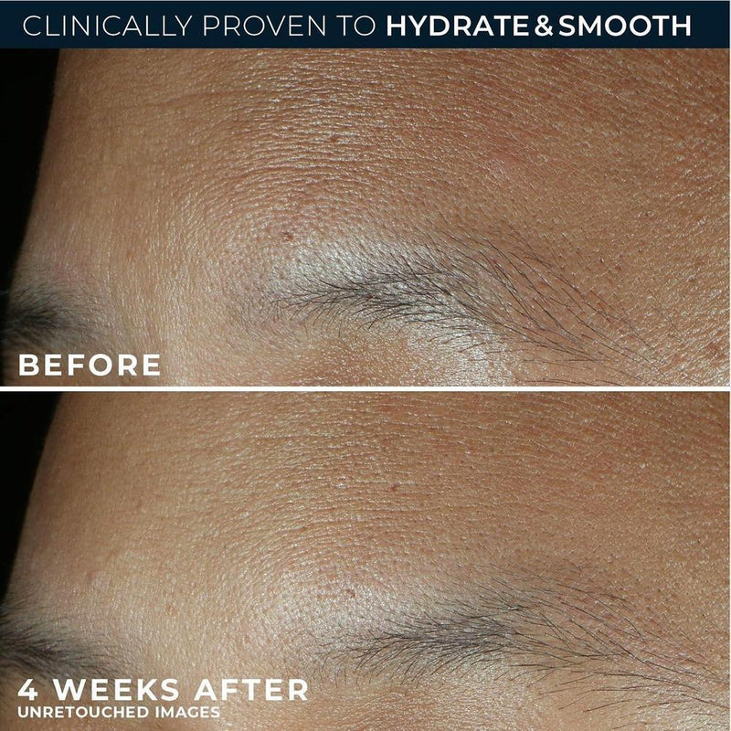 Roc Hidratante Facial Retinol Correxion Ácido Hialurónico 1.7oz