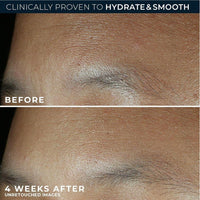 Roc Hidratante Facial Retinol Correxion Ácido Hialurónico 1.7oz