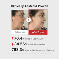 Medicube Age-R Booster Pro 6-en-1 Masajeador de Belleza para Piel Radiante y Firme con Tecnología Coreana