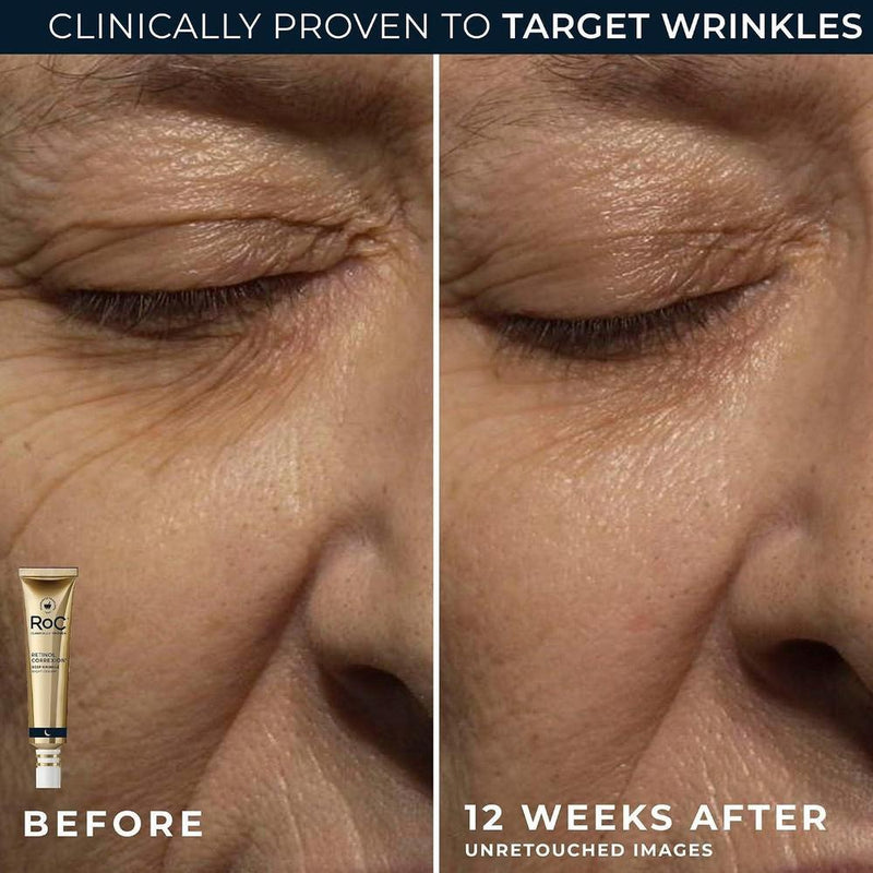 Conjunto Roc: Crema De Noche Y Ojos Con Retinol + 45ml
