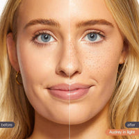 Freckle Stamp De Tarte Para Pecas Naturales