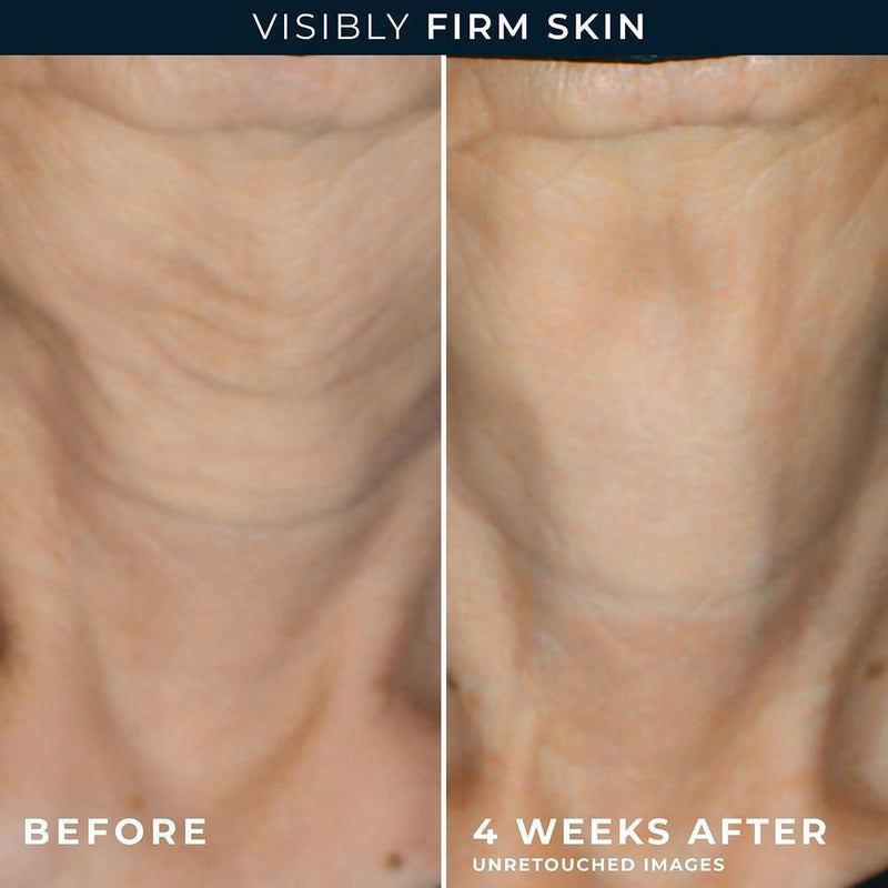 RoC Crema diaria antienvejecimiento para arrugas en rostro y cuello con cápsulas de retinol para suavizar líneas de expresión