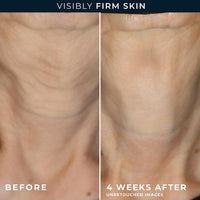 RoC Crema diaria antienvejecimiento para arrugas en rostro y cuello con cápsulas de retinol para suavizar líneas de expresión