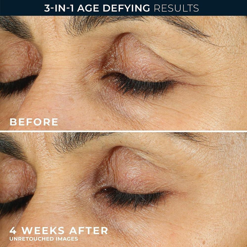 Roc Retinol Crema De Ojos Para Ojeras, Hinchazón Y Arrugas, 7.5g