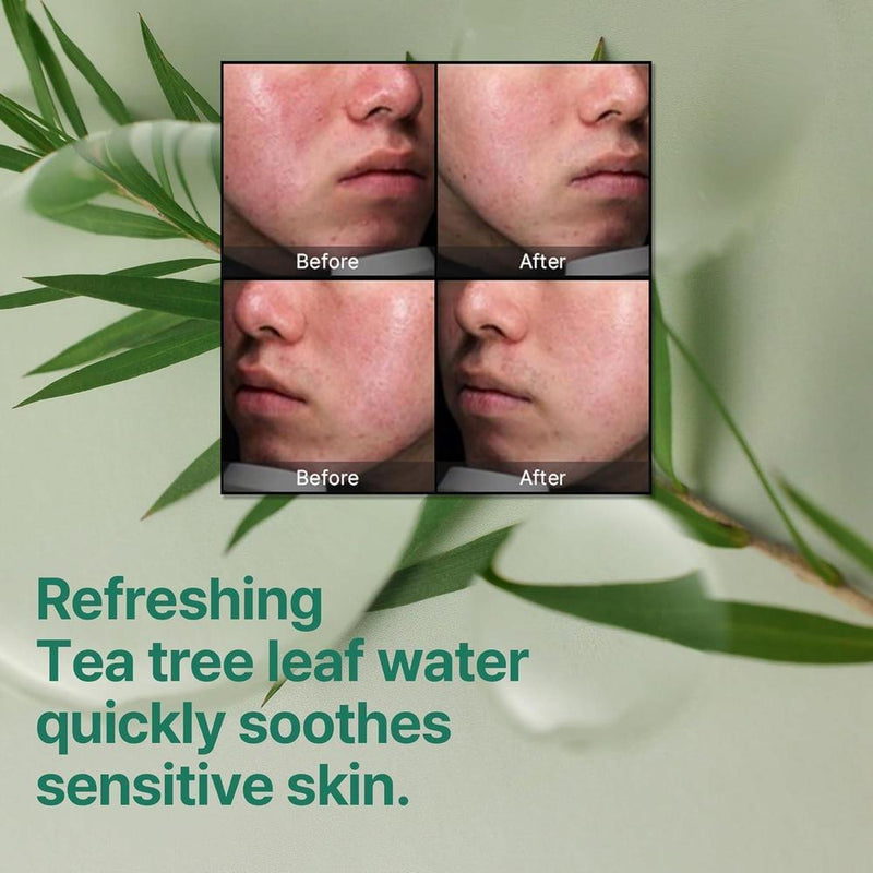 Some By Mi Aha Bha Pha Miracle Cream Hidratante Exfoliante Y Calmante Facial 60ml