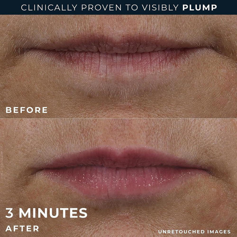 RoC Derm Correxion Lip Volumizer, tratamiento labial con ácido hialurónico y vitamina E, incluye crema suavizante de ojos