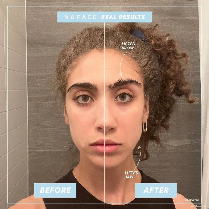 Dispositivo portátil NuFACE Mini para tonificación de la piel del rostro, mejora el contorno y reduce líneas finas