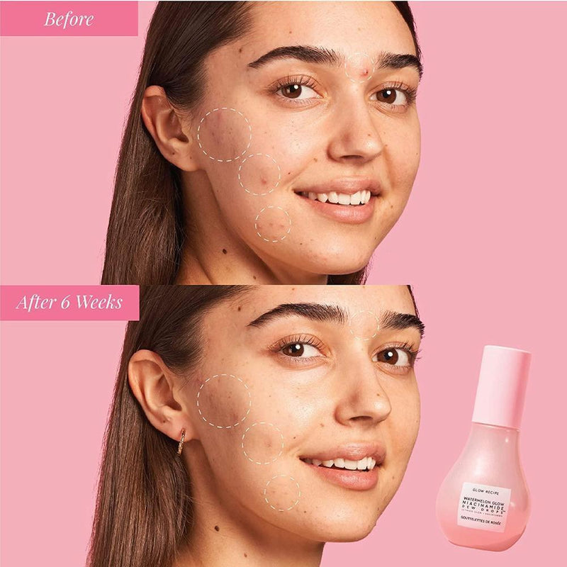 Watermelon Glow Sérum Facial Dew Drops con Niacinamida