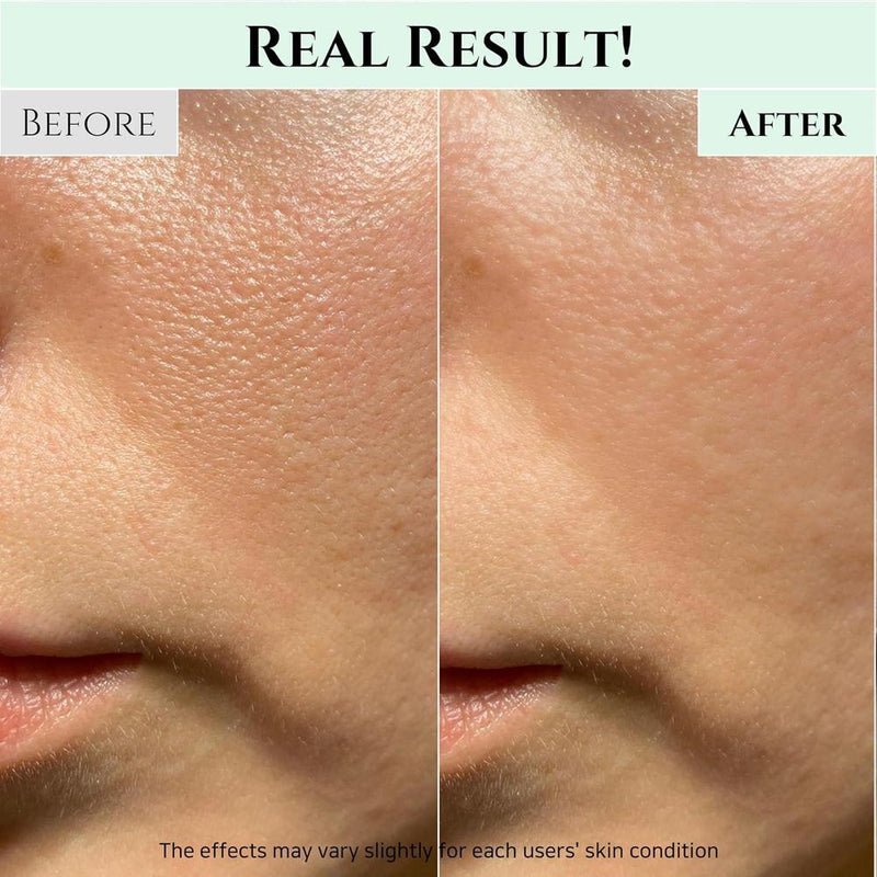Beauty Of Joseon Limpiador Gel Refrescante Anti Acné Y Puntos Negros 100ml