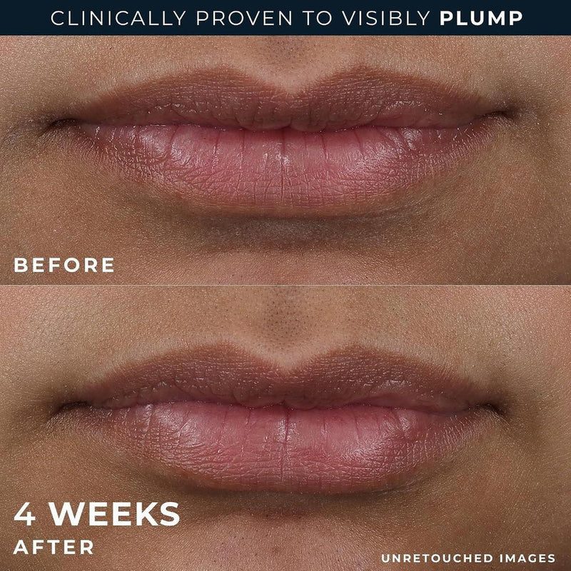 RoC Derm Correxion Lip Volumizer, tratamiento labial con ácido hialurónico y vitamina E, incluye crema suavizante de ojos