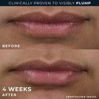RoC Derm Correxion Lip Volumizer, tratamiento labial con ácido hialurónico y vitamina E, incluye crema suavizante de ojos