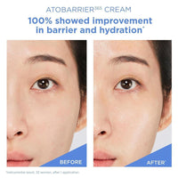 Aestura Atobarrier365 Crema Facial Hidratante Con Ceramidas 80ml