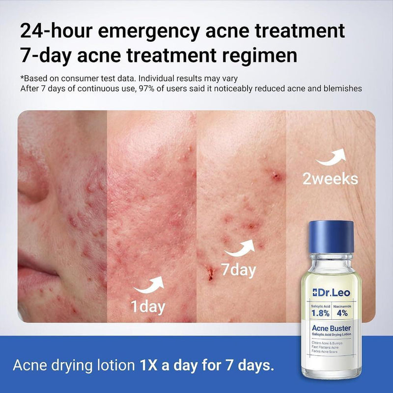 Tratamiento De Manchas De Acné Con Ácido Salicílico Dr.Leo 1.8%, 20ml