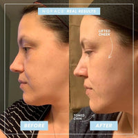 Dispositivo portátil NuFACE Mini para tonificación de la piel del rostro, mejora el contorno y reduce líneas finas