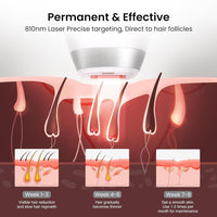 DermRays Depilación láser de diodo para hombres y mujeres, V8S para tono de piel 1-5, reducción permanente en el vello