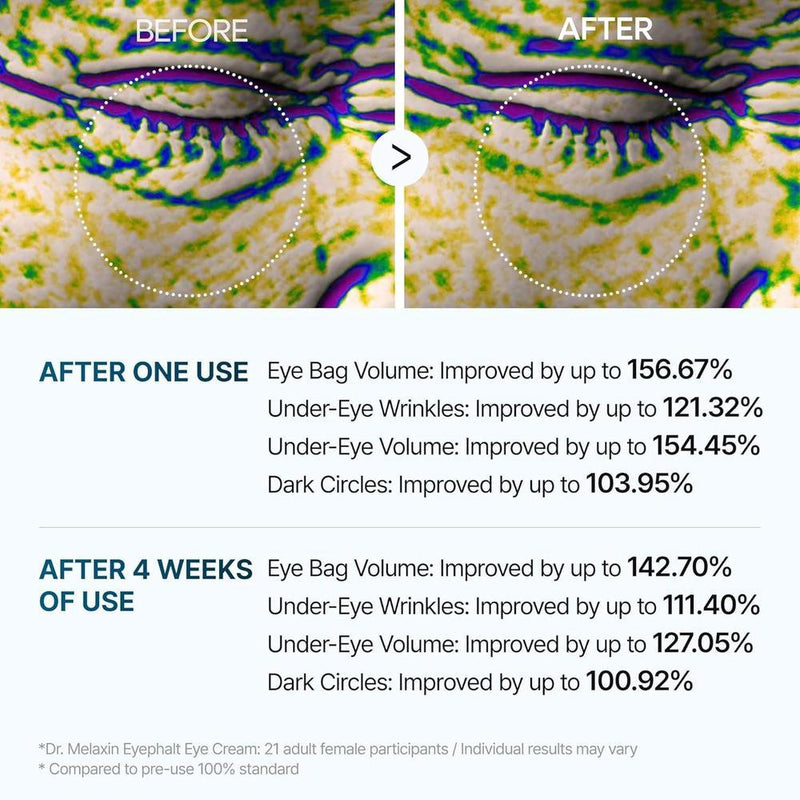 Crema para Bolsas de Ojos Dr.Melaxin Eyephalt, reducción de hinchazón y ojeras, mejora la elasticidad con EGF y Bio-Spicule